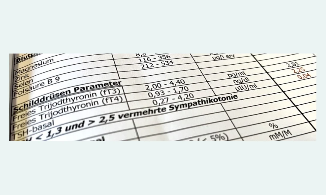 Erfahrungsbericht zur Mikronährstoffanalyse, männlich, 48 Jahre, Wissensarbeiter