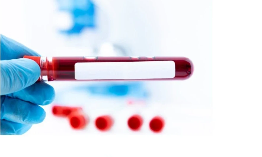 Diabetes und Mikronährstoffe