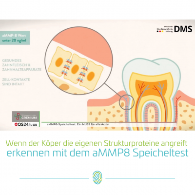 Erkennen, wenn der Köper die eigenen Strukturproteine angreift mit dem aMMP8 Speicheltest