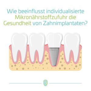 Gesundheit von Zahnimplantaten fördern mit Mikronährstoffen