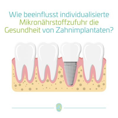 Wie beeinflusst individualisierte Mikronährstoffzufuhr die Gesundheit von Zahnimplantaten?